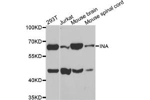 Western blot analysis of extracts of various cell lines, using INA antibody (ABIN5971591) at 1:400 dilution. (INA antibody)