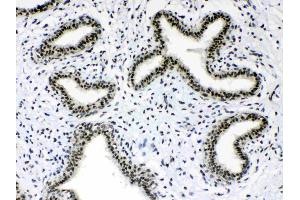 IHC analysis of Musashi 1/Msi1 using anti- Musashi 1/Msi1 antibody . (MSI1 antibody  (N-Term))