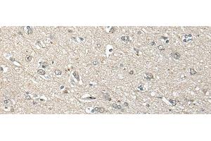 Immunohistochemistry of paraffin-embedded Human brain tissue using UCN3 Polyclonal Antibody at dilution of 1:55(x200) (UCN3 antibody)