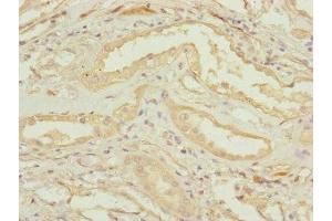 Immunohistochemistry of paraffin-embedded human kidney tissue using ABIN7147433 at dilution of 1:100 (CCDC41 antibody  (AA 34-260))
