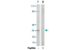 Western blot analysis of extracts from HepG2 cells, using CA13 polyclonal antibody .