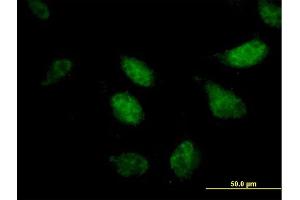 Immunofluorescence of purified MaxPab antibody to ZNF342 on HeLa cell.