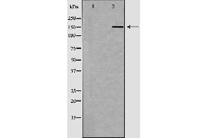 Western blot analysis of Hela whole cell lysates, using MSH6 Antibody. (MSH6 antibody  (Internal Region))