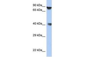 Image no. 1 for anti-Zinc Finger Protein 429 (ZNF429) (AA 143-192) antibody (ABIN6743552) (ZNF429 antibody  (AA 143-192))