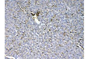 IHC analysis of HBD using anti-HBD antibody . (HBd antibody  (AA 2-147))