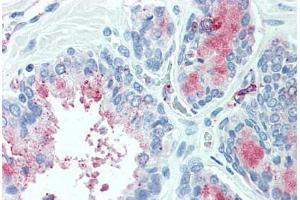 Anti-TSPAN13 antibody  ABIN960830 IHC staining of human prostate. (TSPAN13 antibody  (Internal Region))