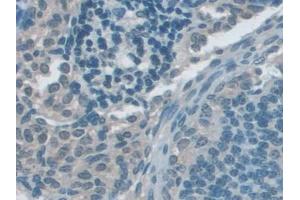 Immunohistochemistry (IHC) image for anti-Glycogen Synthase Kinase 3 alpha (GSK3a) (AA 122-406) antibody (ABIN1859083)