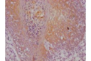 IHC image of ABIN7180967 diluted at 1:100 and staining in paraffin-embedded human tonsil tissue performed on a Leica BondTM system. (Cytokeratin 5 antibody)