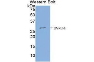 Western Blotting (WB) image for anti-Protein Inhibitor of Activated STAT, 1 (PIAS1) (AA 409-645) antibody (ABIN1860208) (PIAS1 antibody  (AA 409-645))