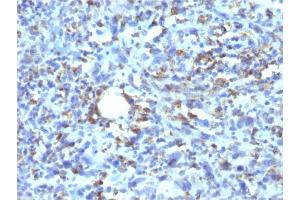 Formalin-fixed, paraffin-embedded human Histiocytoma stained with CD68 Recombinant Mouse Monoclonal Antibody (rLAMP4/824). (Recombinant CD68 antibody)