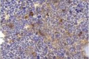 Immunohistochemistry analysis of paraffin-embedded mouse bone using BMP4 (ABIN7073215) at dilution of 1:2000. (BMP4 antibody)