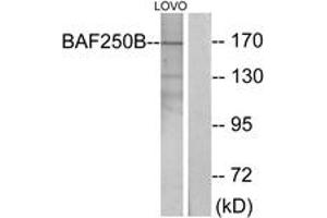 Western blot analysis of extracts from LOVO cells, using BAF250B Antibody. (ARID1B antibody  (AA 1371-1420))