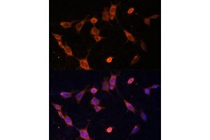 Immunofluorescence analysis of NIH-3T3 cells using UFC1 Polyclonal Antibody (ABIN6130770, ABIN6149886, ABIN6149887 and ABIN6217098) at dilution of 1:100 (40x lens). (UFC1 antibody  (AA 1-167))