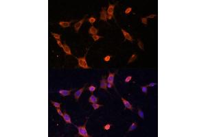 Immunofluorescence analysis of NIH-3T3 cells using UFC1 Polyclonal Antibody (ABIN6130770, ABIN6149886, ABIN6149887 and ABIN6217098) at dilution of 1:100 (40x lens).