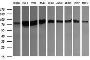 Image no. 3 for anti-CD22 Molecule (CD22) antibody (ABIN1497211) (CD22 antibody)