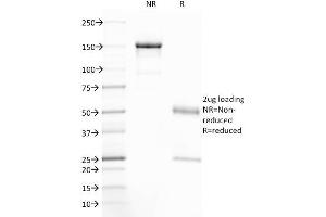SDS-PAGE Analysis Purified CFTR Mouse Monoclonal Antibody (CFTR/1785). (CFTR antibody  (AA 258-385))