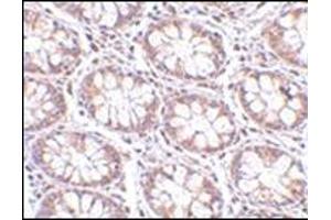 Immunohistochemistry of STEAP2 in human colon tissue with this product at 2. (STEAP2 antibody  (C-Term))