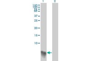 Western Blot analysis of S100A2 expression in transfected 293T cell line by S100A2 monoclonal antibody (M03A), clone 3H8.