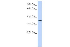 Septin 12 antibody used at 1 ug/ml to detect target protein. (Septin 12 antibody  (Middle Region))