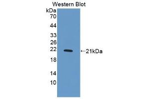 Detection of Recombinant PDGFBB, Human using Polyclonal Antibody to Platelet Derived Growth Factor BB (PDGF BB) (PDGF-BB Homodimer (AA 82-190) antibody)