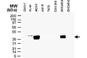 Western blot analysis of CARD8 in tumor cell lines. (CARD8 antibody)
