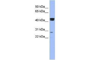 WB Suggested Anti-HSFY1 Antibody Titration:  0.