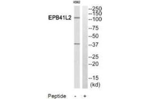 Western blot analysis of extracts from HuvEc cells and HeLa cells, using PPP2R5A antibody. (PPP2R5A antibody)