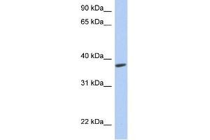 WB Suggested Anti-RTDR1 Antibody Titration: 0.