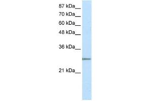 WB Suggested Anti-C20ORF20 Antibody Titration: 2. (MRGBP antibody  (N-Term))