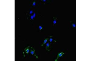 Immunofluorescent analysis of Hela cells using ABIN7159790 at dilution of 1:100 and Alexa Fluor 488-congugated AffiniPure Goat Anti-Rabbit IgG(H+L) (MAST1 antibody  (AA 687-879))