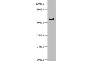Western blot All lanes: G protein-coupled receptor kinase 6 antibody at 6 μg/mL + Rat heart tissue Secondary Goat polyclonal to rabbit IgG at 1/10000 dilution Predicted band size: 66, 68, 65 kDa Observed band size: 66 kDa (GRK6 antibody  (AA 1-170))