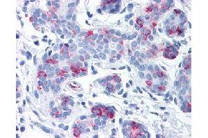 Immunohistochemical (Formalin/PFA-fixed paraffin-embedded sections) staining in human breast with WNT8A polyclonal antibody . (WNT8A antibody)