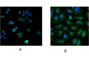 Immunofluorescence staining of MCF7 (A) and HeLa (B) cells with 5ug/ml ABIN184900 antibody. (UBE2L3 antibody  (C-Term))
