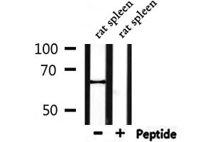 Western blot analysis of extracts from rat spleen, using PTHR1 Antibody. (PTH1R antibody  (pThr1))