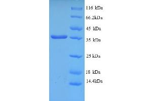 SDS-PAGE (SDS) image for Major Histocompatibility Complex Class I C (HLA-C) (AA 25-308), (partial) protein (His tag) (ABIN5712960)
