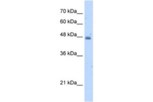 Western Blotting (WB) image for anti-Kynureninase (L-Kynurenine Hydrolase) (KYNU) antibody (ABIN2462922) (KYNU antibody)