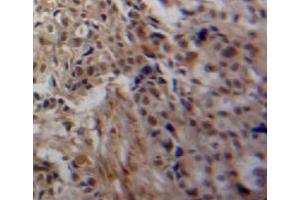 #VALUE! (TGM3 antibody  (AA 468-693))