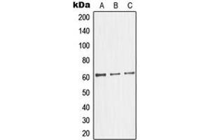 Western blot analysis of Glycerol Kinase 2 expression in HepG2 (A), HeLa (B), Jurkat (C) whole cell lysates.
