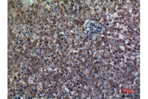 Immunohistochemistry (IHC) analysis of paraffin-embedded Human Liver, antibody was diluted at 1:100. (ALDH1A1 antibody  (N-Term))