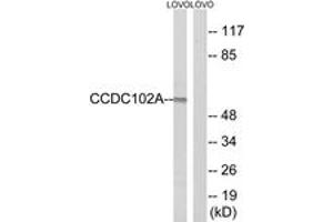 Western blot analysis of extracts from LOVO cells, using CCDC102A Antibody. (CCDC102A antibody  (AA 341-390))