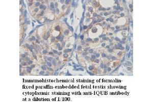 Image no. 1 for anti-IQ Motif and Ubiquitin Domain Containing (IQUB) antibody (ABIN1577302)