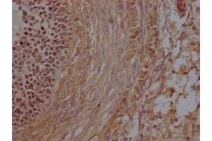 IHC image of ABIN7176722 diluted at 1:200 and staining in paraffin-embedded human ovarian tissue performed on a Leica BondTM system. (ZP2 antibody  (AA 440-716))
