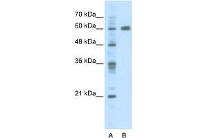 WB Suggested Anti-PDLIM5 Antibody Titration:  2.