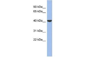 WB Suggested Anti-GJD4 Antibody Titration:  0. (GJD4 antibody  (Middle Region))