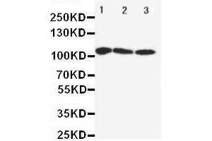 Anti-SERCA1 ATPase antibody, Western blotting Lane 1: Rat Skeletal Muscle Tissue Lysate Lane 2: PANC Cell Lysate Lane 3: U87 Cell Lysate (ATP2A1/SERCA1 antibody  (Middle Region))