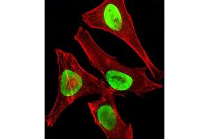 Immunofluorescence (IF) image for anti-Enhancer of Zeste Homolog 2 (EZH2) antibody (ABIN659002)