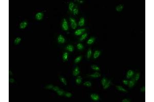 Immunofluorescence staining of Hela cells with ABIN7139632 at 1:25, counter-stained with DAPI. (HIST1H3A antibody  (pTyr41))