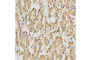 Immunohistochemistry of paraffin-embedded human stomach using PRDX4 antibody at dilution of 1:200 (x400 lens) (Peroxiredoxin 4 antibody  (AA 38-271))