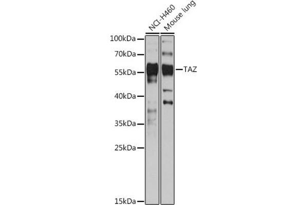 WWTR1 anticorps  (C-Term)