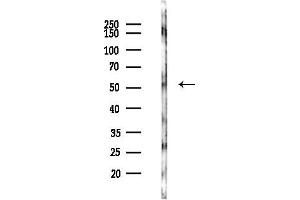 anti-Cerebral Cavernous Malformation 2 (CCM2) (Internal Region) antibody